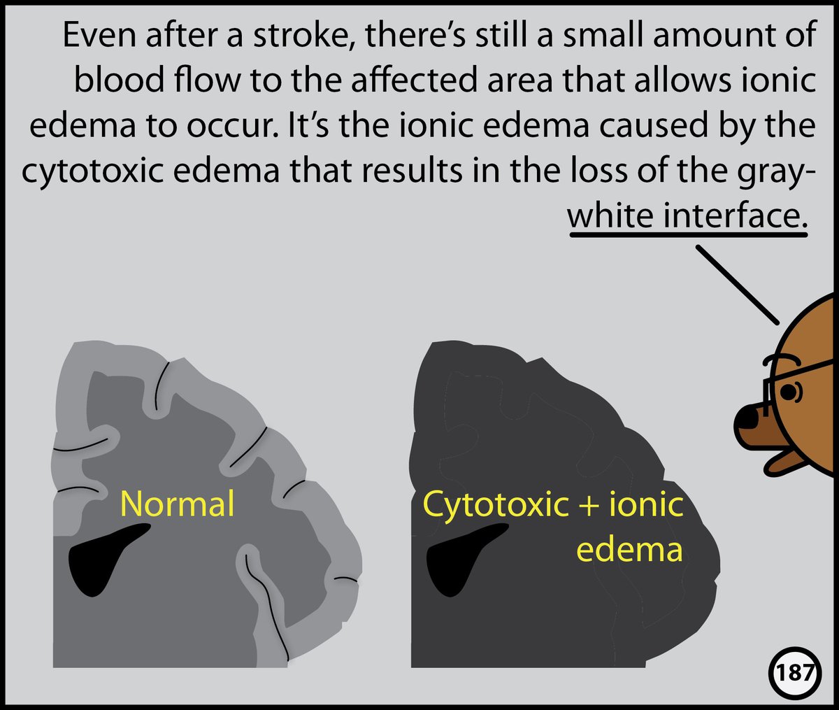 StefanTigges's tweet image. This month, I’ll post excerpts from our Head CT comic. The complete comic is available for free here: radiopaedia.org/courses/head-c…