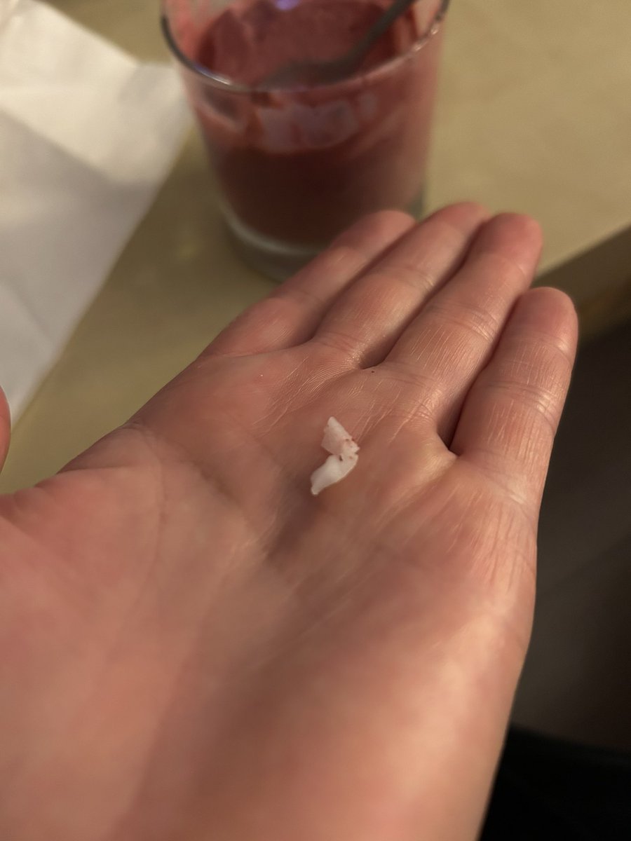 2muchsas's tweet photo. @BoschUK bought a Bosch series 6 blender a few weeks back.  Made fruit yoghurt for my kids tonight and they complained about hard bits.  These turned out to be parts of plastic from the blade attachment.  How could this happen? https://t.co/mRcPILxSVb