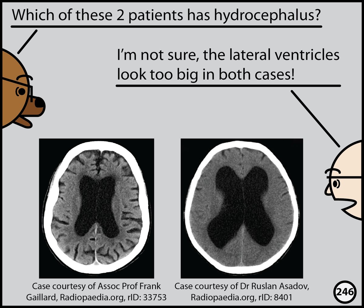 StefanTigges's tweet photo. This month, I’ll post excerpts from our Head CT comic. The complete comic is available for free here: https://t.co/wPeVKtgGBe https://t.co/woSg8X6XeD