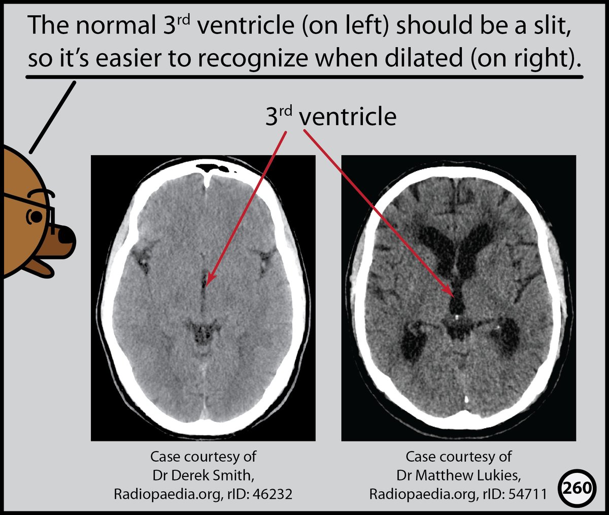 StefanTigges's tweet photo. This month, I’ll post excerpts from our Head CT comic. The complete comic is available for free here: https://t.co/wPeVKtgGBe https://t.co/5qRtBy4t56