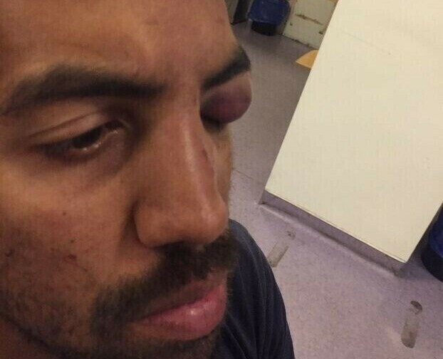 Cycliste, Maxime a été passé à tabac par un homme à scooter alors qu'il se trouvait à une porte de Paris, arrêté à un feu rouge

Il a eu 4 fractures au visage, notamment autour de l’œil et au nez et a dû se faire opérer ce vendredi

➡️ l.leparisien.fr/GovQ