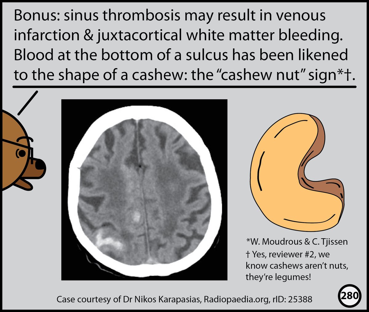 StefanTigges's tweet photo. This month, I’ll post excerpts from our Head CT comic. The complete comic is available for free here: https://t.co/wPeVKtgGBe https://t.co/gIBctw2ibt
