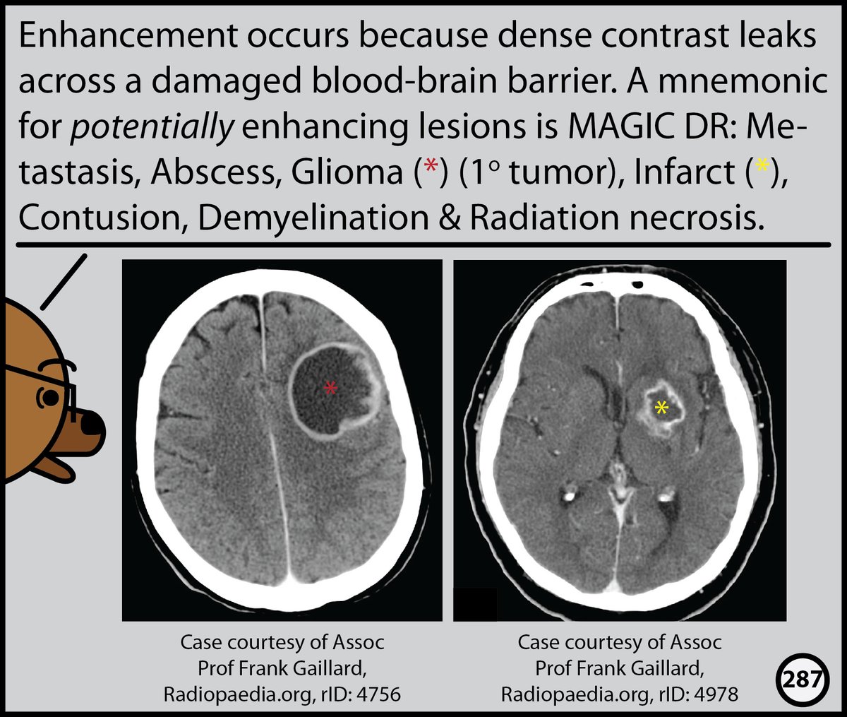 This month, I’ll post excerpts from our Head CT comic. The complete comic is available for free here: radiopaedia.org/courses/head-c…
