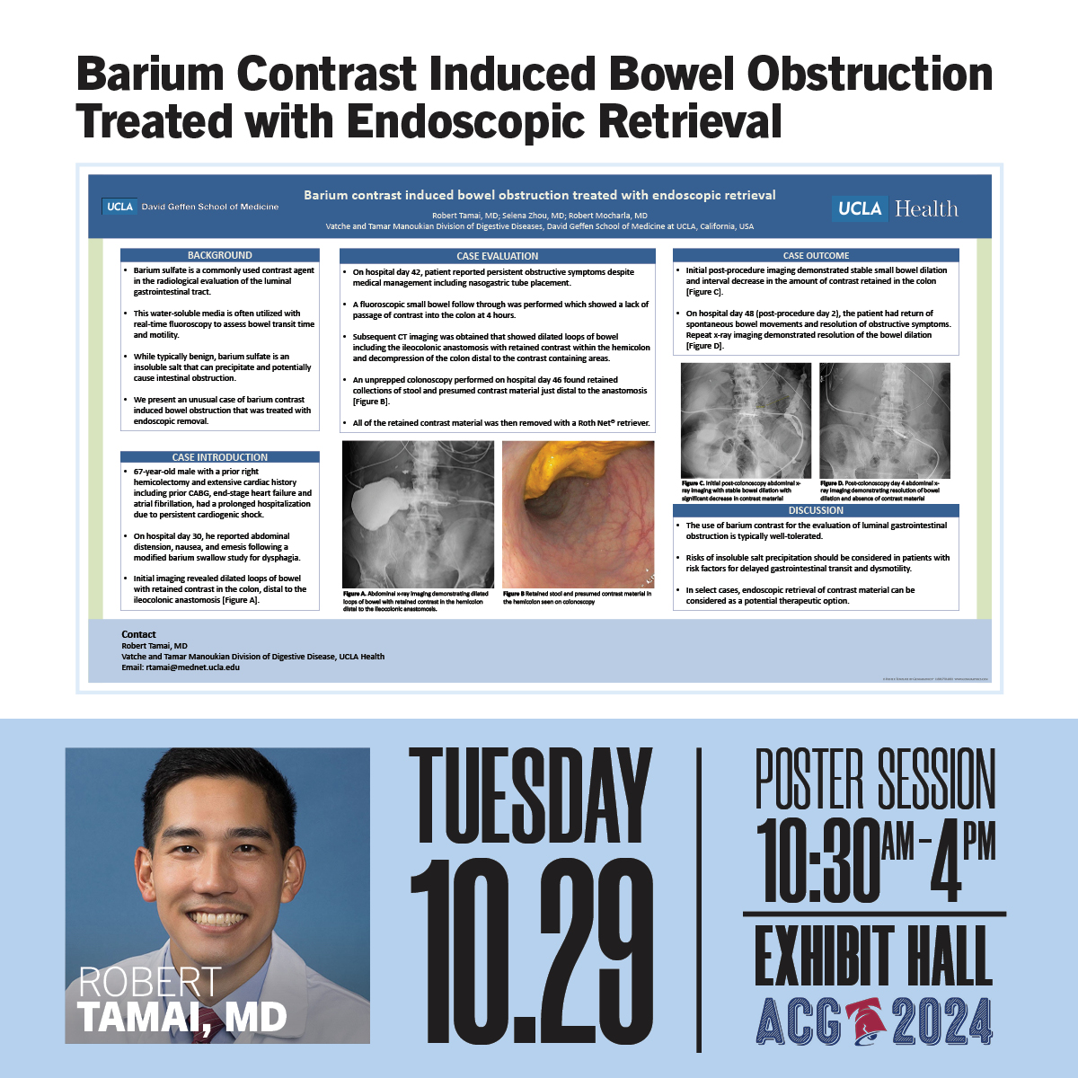 UCLA Gastroenterology and Hepatology (@uclagihep) on Twitter photo Barium Contrast Induced Bowel Obstruction Treated with Endoscopic Retrieval
🌠Dr. Robert Tamai (<a href="/RobertTamai/">Robert Tamai</a>)
👥<a href="/selena_zhou/">Selena Zhou, MD</a> Robert Mocharla
👉Tuesday, October 29, 10:30am - 4pm, #ACG2024 Barium Contrast Induced Bowel Obstruction Treated with Endoscopic Retrieval
🌠Dr. Robert Tamai (<a href="/RobertTamai/">Robert Tamai</a>)
👥<a href="/selena_zhou/">Selena Zhou, MD</a> Robert Mocharla
👉Tuesday, October 29, 10:30am - 4pm, #ACG2024