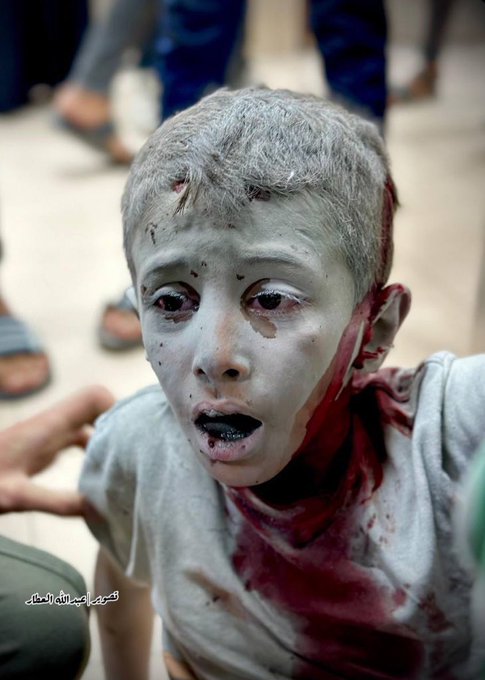 PLEASE DON'T SKIP ME :((
🚨My account has been restricted, 
So, my gfm doesn't appear to everyone! 
Please support my family gfm !!
by sharing and quoting and donating 💔🙏🏻
Please, Leave a comment 🇵🇸 or RT 🍉
gofund.me/db6b7feb