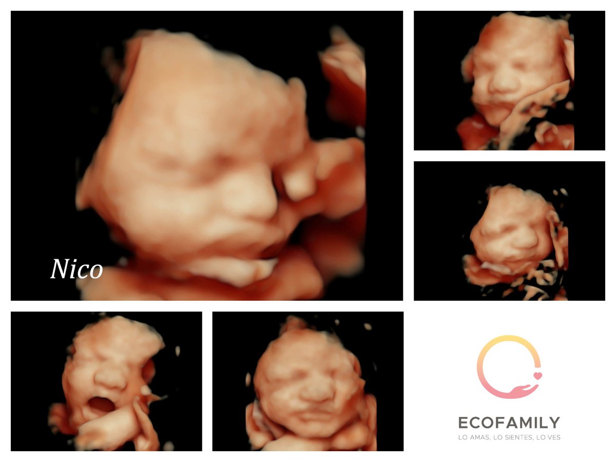 Fernanpat7's tweet photo. 33 semanas llenita de amor 🥰
Deseando tenerte en mis brazos 💞 https://t.co/XFa1C4lO1k