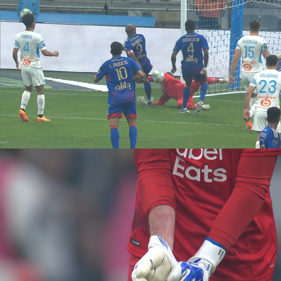 Foudaff_'s tweet photo. ça me fait penser à Pau Lopez quand il a montré la trace des crampons de Dembele sur son avant bras sauf qu'il a pris un jaune pour s'être plaint ptdrrrr https://t.co/07RtEIQCel