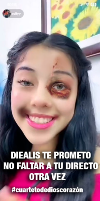 Alexmon119's tweet photo. @hereismirandaa @Alejus28 La nueva victima del boxeador de mujeres https://t.co/1FpFL9NHcj