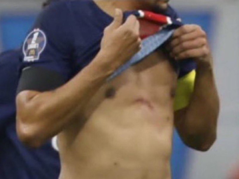 Wesh je pensais y’avait pas rouge mais y’a rouge tout les jours en vrai