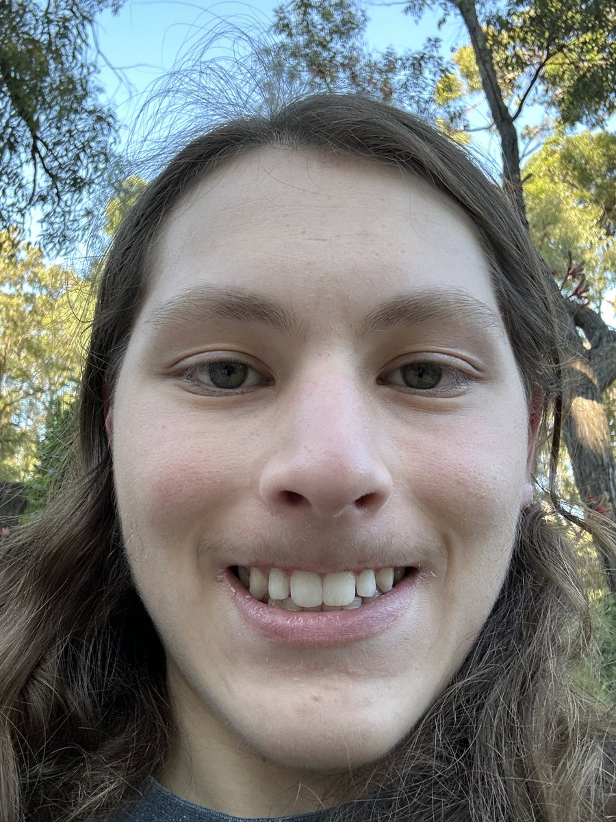 Did the mr beast smile