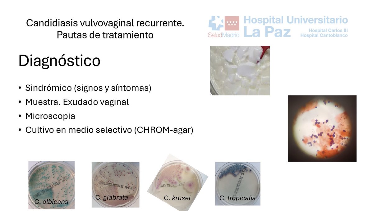 Micro_LaPaz's tweet photo. 🖥️ #Sesión: 🌟 Repasamos la #candidiasis vulvovaginal #recurrente 🍄 a manos de @SheilaMRodri 👩🏾🔬 ¡Enhorabuena! 👏🏼🥳 https://t.co/HDp6Ld9eRT