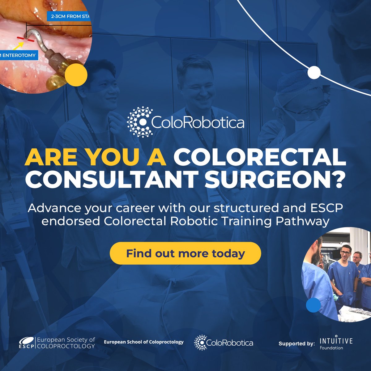 Are you a colorectal consultant surgeon? 🏥

Discover the power of robotic surgery and see how you can lead in patient care and innovation.

Join now ➡️ europeansocietyofcoloproctology.eu/education/euro…

#HealthTech #SurgicalTraining