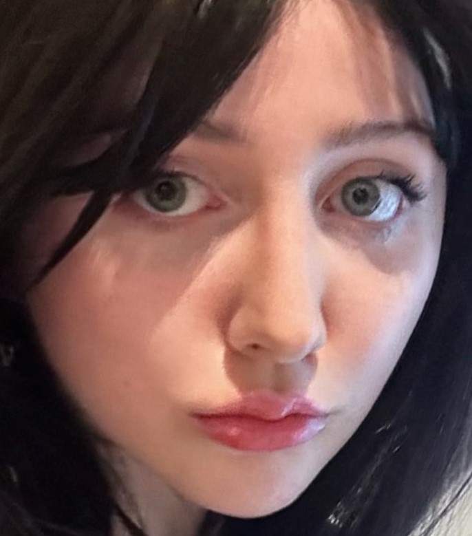 RecessedChin's tweet image. 