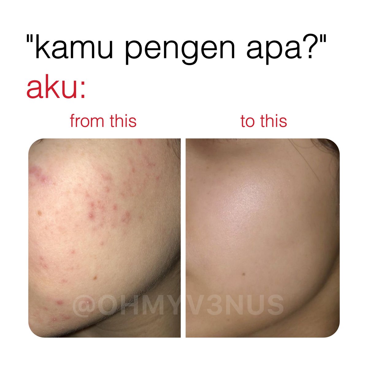 OHMYV3NUS's tweet image. 