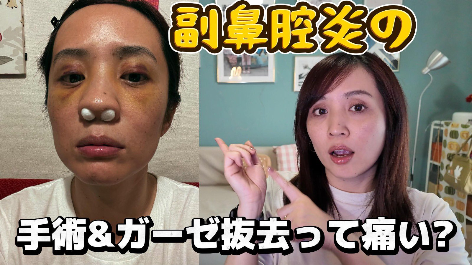女性鼻の穴高画質 痛くない美鼻矯正その１】鼻筋はマッサージで作れる！K-POPアイドルのような美鼻を作るメソッドをご紹介！ - YouTube