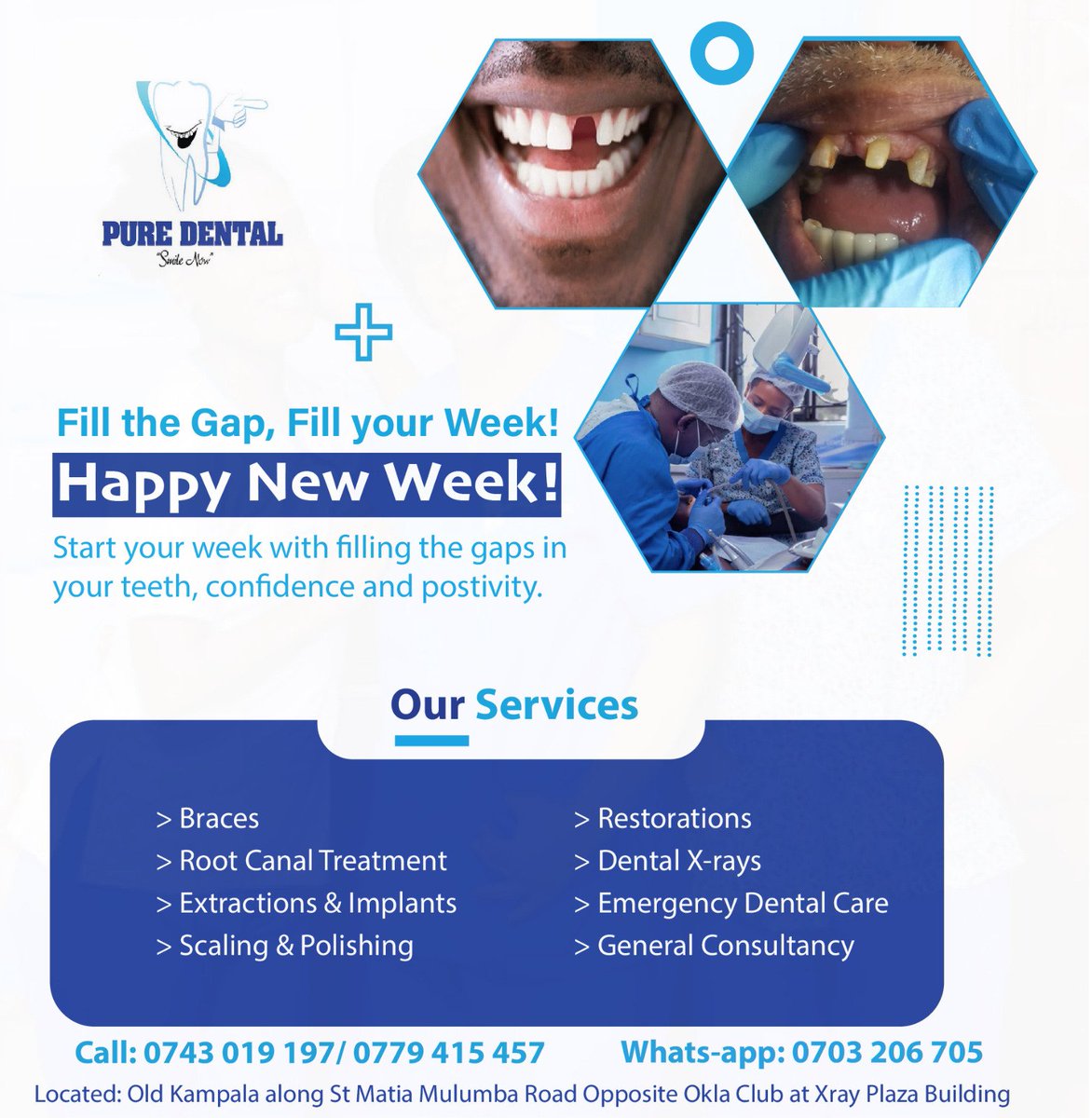 PureDental90's tweet photo. @Ssenyonyiderick New week, new smiles!
Let’s fill the gaps and make every tooth count.
Missing teeth?
Our team at @PureDental90 is here to restore your smile and confidence.
Let’s make it a week of healthy, complete smiles!
Whats-app 0703 206 705 now.
#FillTheGaps #NewWeekNewSmile #DentalCare https://t.co/ONck4O79Kb