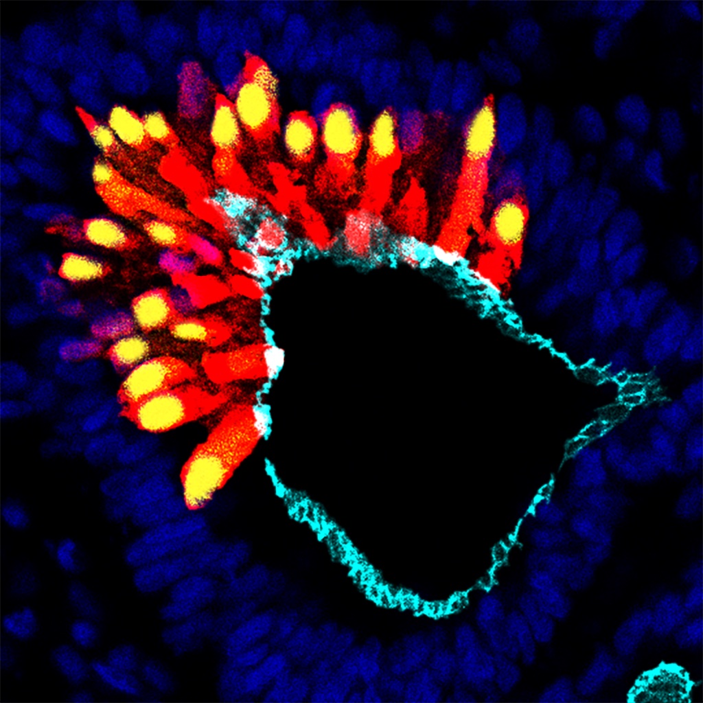 Australasian Society for Stem Cell Research (@the_asscr) on Twitter photo Congratulations to our ASSCR Image Competition winner, Vivienne Kaiser from <a href="/CMRI_AUS/">CMRI</a>
& our runner-ups (4-way tie):
<a href="/RitikaSxn/">Ritika Saxena 🩸(I like RUNX1)</a> from <a href="/MCRI_for_kids/">Murdoch Children's Research Institute (MCRI)</a>
Roshantha Perera from <a href="/MonashUni/">Monash University</a>
<a href="/CMitoKnight/">Cameron McKnight</a> from MCRI
& Vivienne, for a second submission that tied our runner-ups, too! Congratulations to our ASSCR Image Competition winner, Vivienne Kaiser from <a href="/CMRI_AUS/">CMRI</a>
& our runner-ups (4-way tie):
<a href="/RitikaSxn/">Ritika Saxena 🩸(I like RUNX1)</a> from <a href="/MCRI_for_kids/">Murdoch Children's Research Institute (MCRI)</a>
Roshantha Perera from <a href="/MonashUni/">Monash University</a>
<a href="/CMitoKnight/">Cameron McKnight</a> from MCRI
& Vivienne, for a second submission that tied our runner-ups, too!