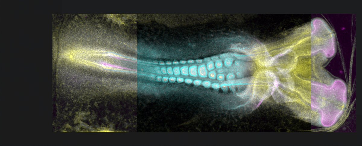 Gurdon Institute (@gurdoninstitute) on Twitter photo This stunning image won our annual image competition and has made its way to our website. It shows twin chicken embryos with a joint body stained for N-cadherin (magenta), actin (yellow) and nuclei (cyan) and was captured by UCL student Brendan Chiong who visited the <a href="/xiongfz/">Fengzhu Xiong</a> lab This stunning image won our annual image competition and has made its way to our website. It shows twin chicken embryos with a joint body stained for N-cadherin (magenta), actin (yellow) and nuclei (cyan) and was captured by UCL student Brendan Chiong who visited the <a href="/xiongfz/">Fengzhu Xiong</a> lab