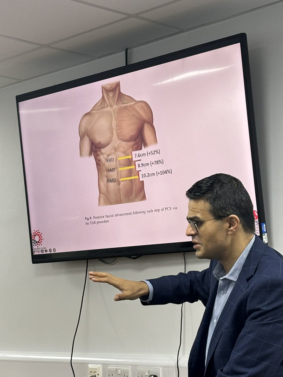 Susanna Green (@susiekgreen) on Twitter photo Fantastic start to the morning at The <a href="/Dukes_Club/">The Dukes' Club</a> AWR course - with Rives Stoppa and Anterior component separation talks followed by practical in the cadaveric lab! Fantastic start to the morning at The <a href="/Dukes_Club/">The Dukes' Club</a> AWR course - with Rives Stoppa and Anterior component separation talks followed by practical in the cadaveric lab!