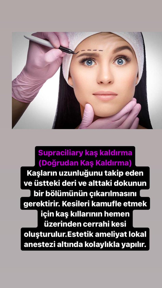 stepestetik's tweet photo. #plastikcerrah #meme #istanbul #aesthetic #surgery #plasticsurgery #estetik #doktor #rhinoplasty #liposuction #tummytuck #plastik #botoks #dolgu #rinoplasti #dudakdolgusu #malatya #kaş #kaşkaldirma #estetikburun #estetikcerrahi #lokal #İstanbul #Germany #england https://t.co/LDWgTODUBf