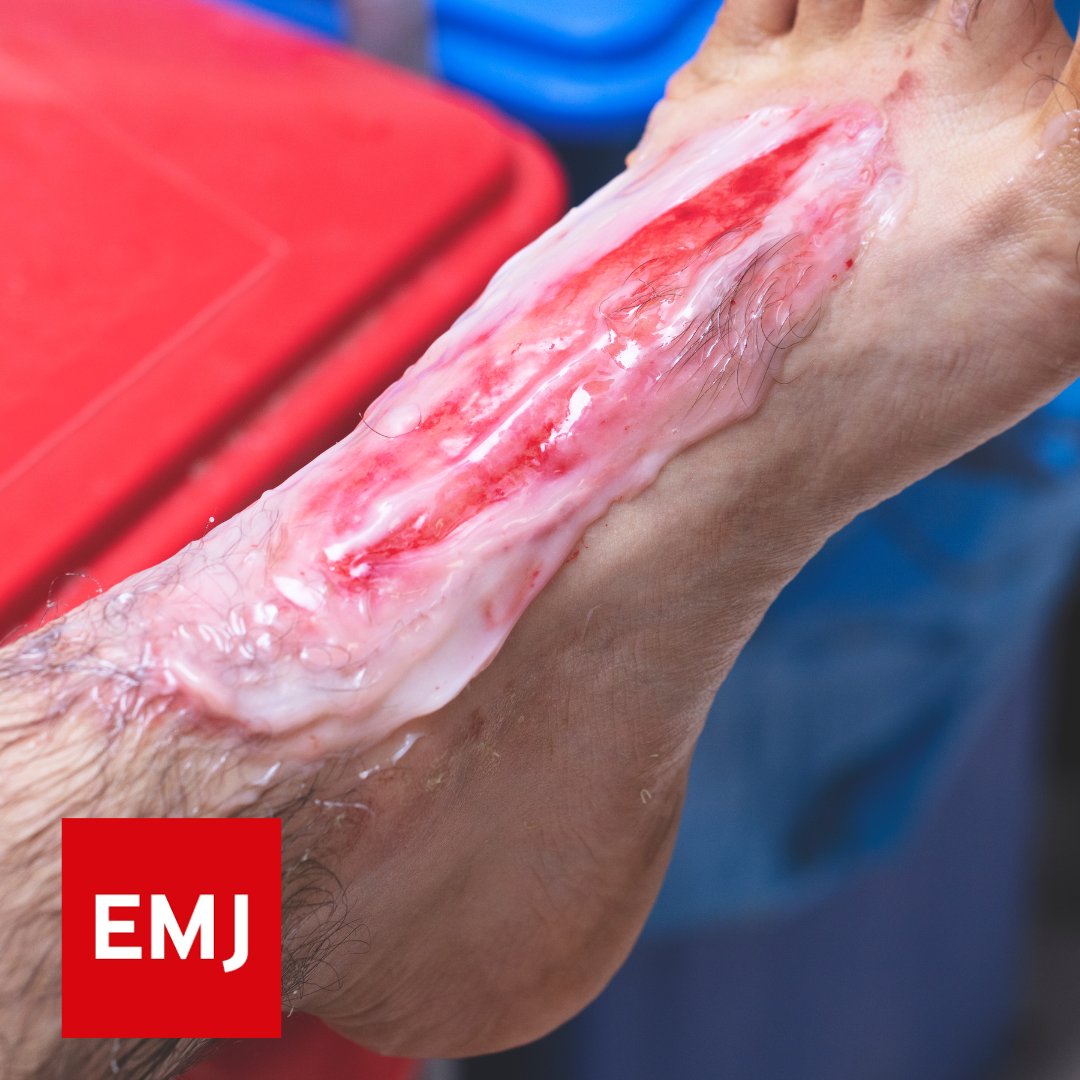 Emergency Medicine Journal tweet media