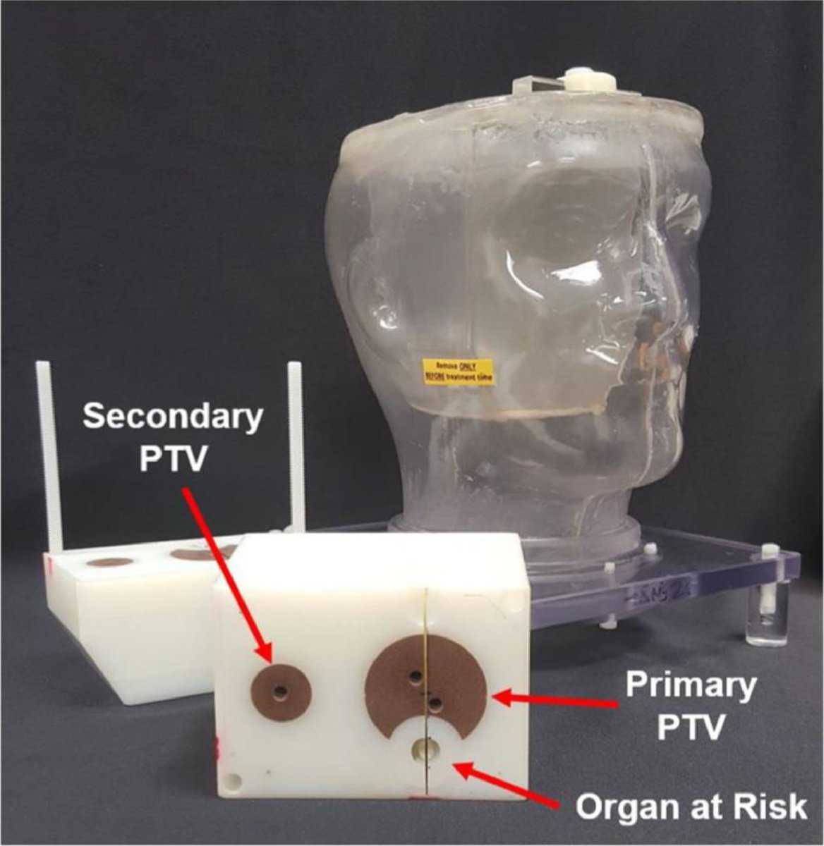 ASTRO_org's tweet image. New in the #RedJournal: Is the IROC H&amp;amp;N credentialing phantom an effective surrogate for different anatomical sites? @freettabrooks, @MalloryCGlenn, @JulieLarkin305, @DrRebeccaHowel1, @CatharineHClark, @MDAndersonNews tinyurl.com/brooksrj