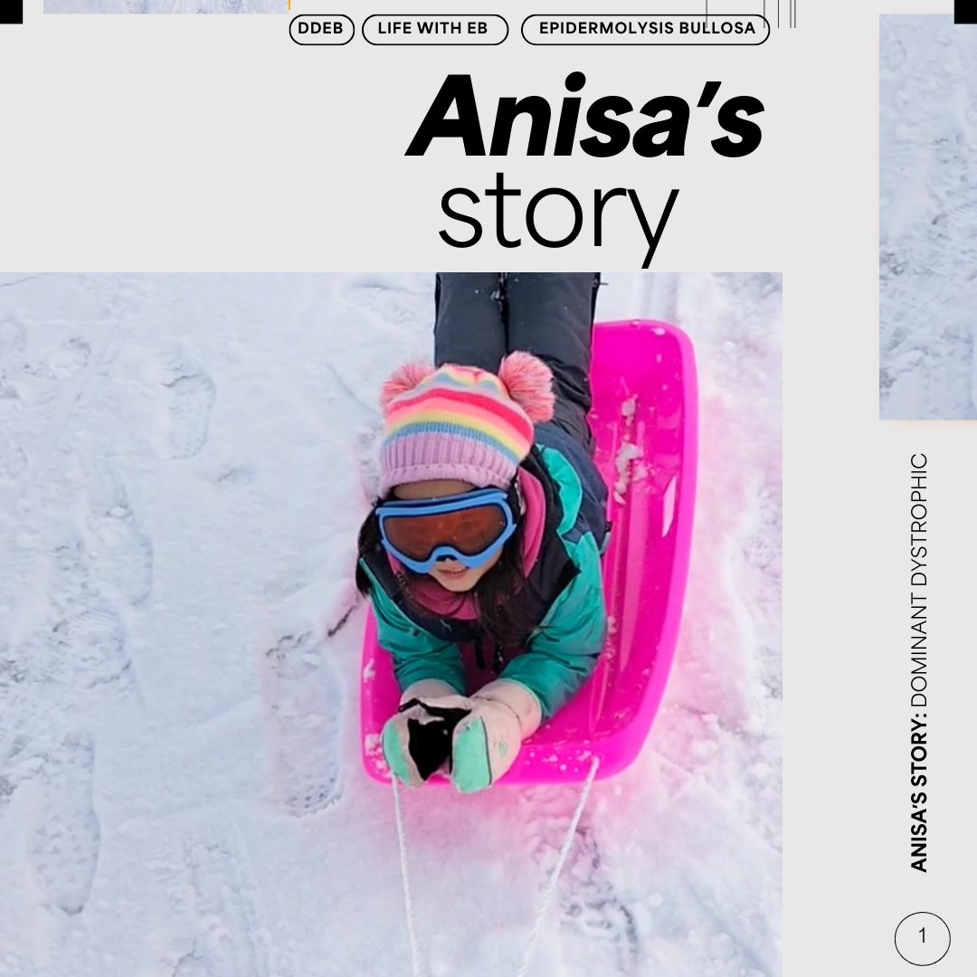 EBResearch's tweet image. #LifeWithEB: Meet Anisa, a fearless 5-year-old with DDEB, inspires with her resilience! Her mom developed adaptive clothing to protect her skin and bring joy. They hope to support other EB families too. 💪💙
Help by taking their survey: bit.ly/LeeAnnesSurvey

#EBRP #EBawareness