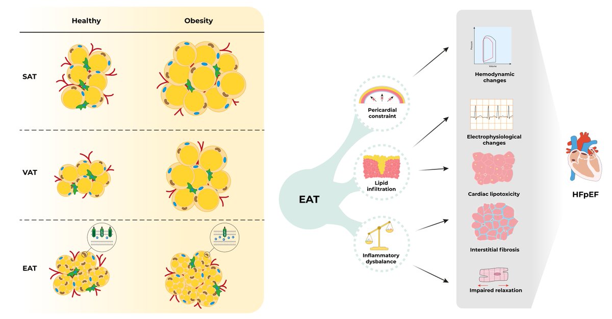 UMCG Cardiology Research Institute (@cardiologyumcg) on Twitter photo Excited to share our department's state-of-the-art <a href="/JACCJournals/">JACC Journals</a> review on obesity and HFpEF! This comprehensive review explores molecular differences in adipose tissues, focusing on epicardial adipose tissue's role in HFpEF pathophysiology. #hf #obesity
jacc.org/doi/10.1016/j.… Excited to share our department's state-of-the-art <a href="/JACCJournals/">JACC Journals</a> review on obesity and HFpEF! This comprehensive review explores molecular differences in adipose tissues, focusing on epicardial adipose tissue's role in HFpEF pathophysiology. #hf #obesity
jacc.org/doi/10.1016/j.…