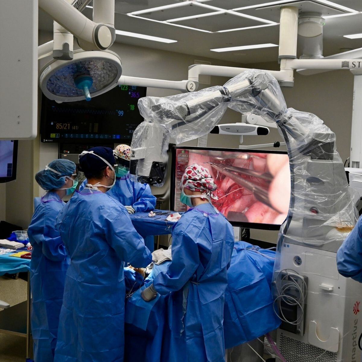 SynaptiveMed's tweet photo. "Performing cleft palate surgery puts significant strain on your cervical spine, exacerbated by the weight of surgical loupes and/or a headlight. Since integrating #ModusX, I can perform these surgeries without neck strain or pain." 
Dr. James Vargo, @ChildrensNE https://t.co/HFVHrhKykb
