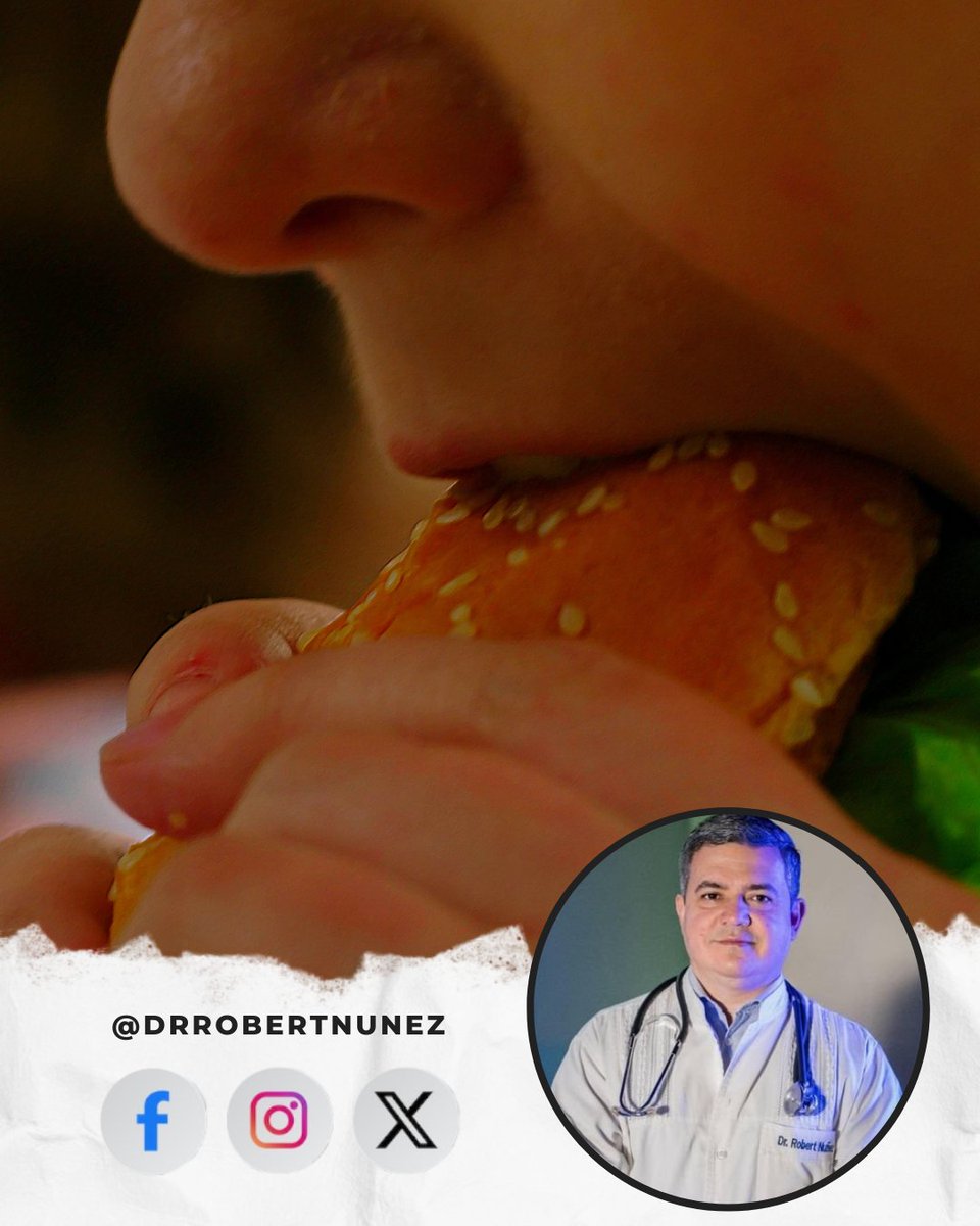 drrobertnunez's tweet photo. Ayer recibí en consultorio a un niño de aproximadamente 8 años, con sobrepeso, quien ya presentaba problemas respiratorios y diabetes infantil. Su madre se resistía a aceptar la realidad, argumentando que en su familia es de "contextura normal" ,"somos luego de huesos grandes". Sin embargo, en Paraguay, según el Ministerio de Salud, alrededor del 34% de los niños y adolescentes presentan sobrepeso u obesidad, una cifra alarmante que crece cada año.

Es fundamental entender que no podemos asociar el sobrepeso con un estado saludable en los niños. Las complicaciones de salud en edades tan tempranas son una señal clara de que debemos actuar. 
La prevención y el cuidado temprano son clave para evitar consecuencias graves a largo plazo.

Algunos consejos para una buena alimentación:

•Fomentar el consumo de frutas, verduras, cereales integrales y proteínas magras.

•Limitar el consumo de alimentos ultraprocesados, bebidas azucaradas y snacks altos en grasas.

•Promover la actividad física diaria y reducir el tiempo frente a pantallas.

•Mantener horarios regulares de comida y enseñar a los niños a escuchar su sensación de saciedad.

🍔🍟No estoy en contra de las comidas chatarras: es completamente normal que los niños quieran comer hamburguesas, papas fritas u otros alimentos similares. Sin embargo, lo ideal sería hacerlo de manera esporádica, y no incluirlos como parte habitual de la dieta diaria. 

Una alimentación balanceada es clave para su desarrollo físico y mental. Aceptar el problema es el primer paso para proteger su bienestar y garantizar un futuro saludable.