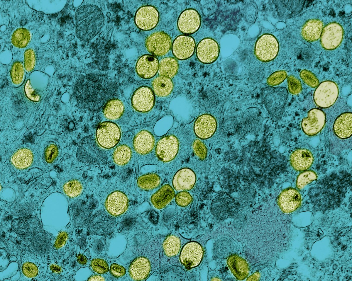 NIAID News (@niaidnews) on Twitter photo A #NIAID sponsored clinical trial of an #mpox #vaccine in adolescents found it was safe and generated an antibody response equivalent to that seen in adults. Learn more: go.nih.gov/hvrKbfT
#IDWeek2024
@BCMHouston <a href="/VUMChealth/">Vanderbilt Health</a> <a href="/SLU_Official/">Saint Louis University</a> A #NIAID sponsored clinical trial of an #mpox #vaccine in adolescents found it was safe and generated an antibody response equivalent to that seen in adults. Learn more: go.nih.gov/hvrKbfT
#IDWeek2024
@BCMHouston <a href="/VUMChealth/">Vanderbilt Health</a> <a href="/SLU_Official/">Saint Louis University</a>