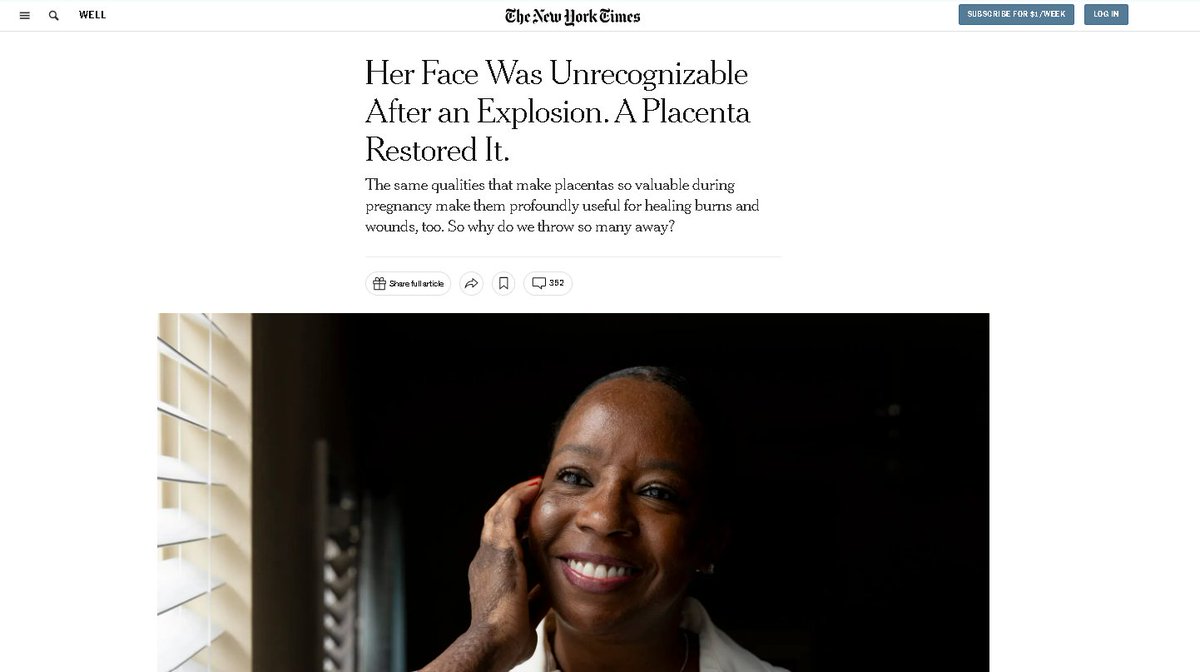 ALPS (American Limb Preservation Society) (@alpslimb) on Twitter photo Breaking News! ALPS Founding President, <a href="/DGArmstrong/">David G. Armstrong follow @dgarmstrong.bsky.social</a>, was recently featured in the <a href="/nytimes/">The New York Times</a>!
The article explores the groundbreaking use of placenta-derived skin grafts to heal burns and chronic wounds. Check it out here: nytimes.com/2024/10/08/welā¦
#WoundHealing #SkinGrafts Breaking News! ALPS Founding President, <a href="/DGArmstrong/">David G. Armstrong follow @dgarmstrong.bsky.social</a>, was recently featured in the <a href="/nytimes/">The New York Times</a>!
The article explores the groundbreaking use of placenta-derived skin grafts to heal burns and chronic wounds. Check it out here: nytimes.com/2024/10/08/welā¦
#WoundHealing #SkinGrafts