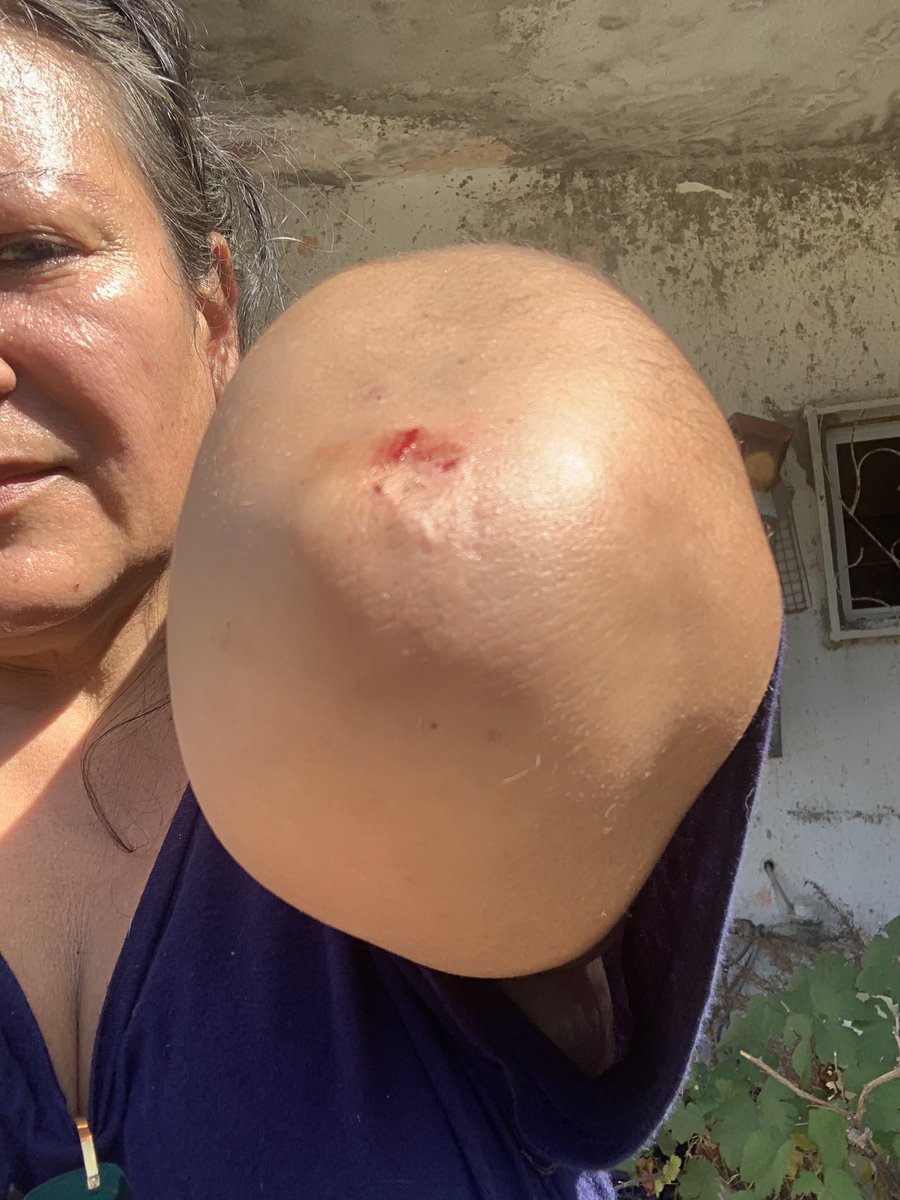 BelishaMar's tweet photo. Thanks @coralclubes If you throw the garbage in your neighbors' house,if you paint the walls of your neighbors with your colors,if you enter to steal your neighbors' house,if you hurt your neighbors…how the people call that in the USA?🥰
@IGFGolf 
@fernandolemmen @luisblancofmg https://t.co/hnZ7qFwHSH
