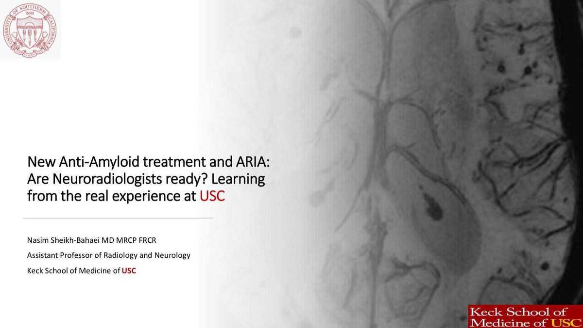 Nasim (@nasimshbahaei) on Twitter photo I will talk about new anti-amyloid treatments and ARIA at #WNRS24 on Friday October 18th!
#alzheimer #ARIA #amyloid #dementia
<a href="/wnrsociety/">The Western Neuroradiological Society</a> <a href="/KeckMedicineUSC/">Keck Medicine of USC</a> <a href="/RadiologyUSC/">Radiology of USC</a> @USCneurorads I will talk about new anti-amyloid treatments and ARIA at #WNRS24 on Friday October 18th!
#alzheimer #ARIA #amyloid #dementia
<a href="/wnrsociety/">The Western Neuroradiological Society</a> <a href="/KeckMedicineUSC/">Keck Medicine of USC</a> <a href="/RadiologyUSC/">Radiology of USC</a> @USCneurorads