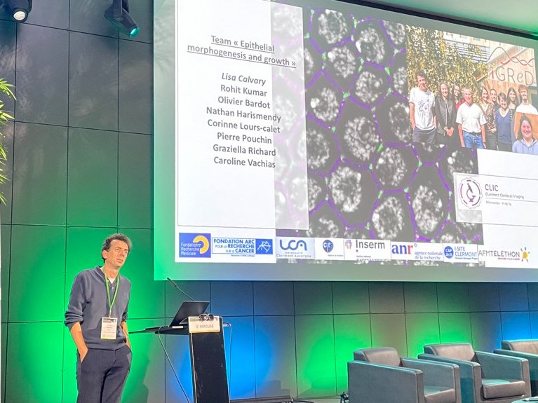 SBCF (@sbcf1) on Twitter photo Vincent Mirouse <a href="/GReD_Clermont/">Institute Genetics, reproduction & development</a> shows important regulation of actin dynamics at the tricellular junction in an epithelium #FromCellToOrganism2024 Vincent Mirouse <a href="/GReD_Clermont/">Institute Genetics, reproduction & development</a> shows important regulation of actin dynamics at the tricellular junction in an epithelium #FromCellToOrganism2024