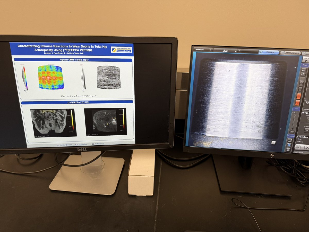 Mako robot set up along with our demo revision case featuring PET/MRI imaging and RedLux implant analysis.