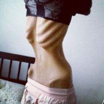 ang3llfr3ak's tweet photo. Daily thinspo 4 u!!
#ana #proana #promia #edtwt #anatwt #thinspo #ednotsheeran #ed #mia #weightloss #starve #bonespo #fatspo #deathspo #ednos #bed #ricecaketwt #skinny #anorexia #fat #meanspo #diet
#anadiet #skinnygirl #mealspo #omad #thighgap #weightgain #rexic #bigspo https://t.co/9f1BLP9MrA