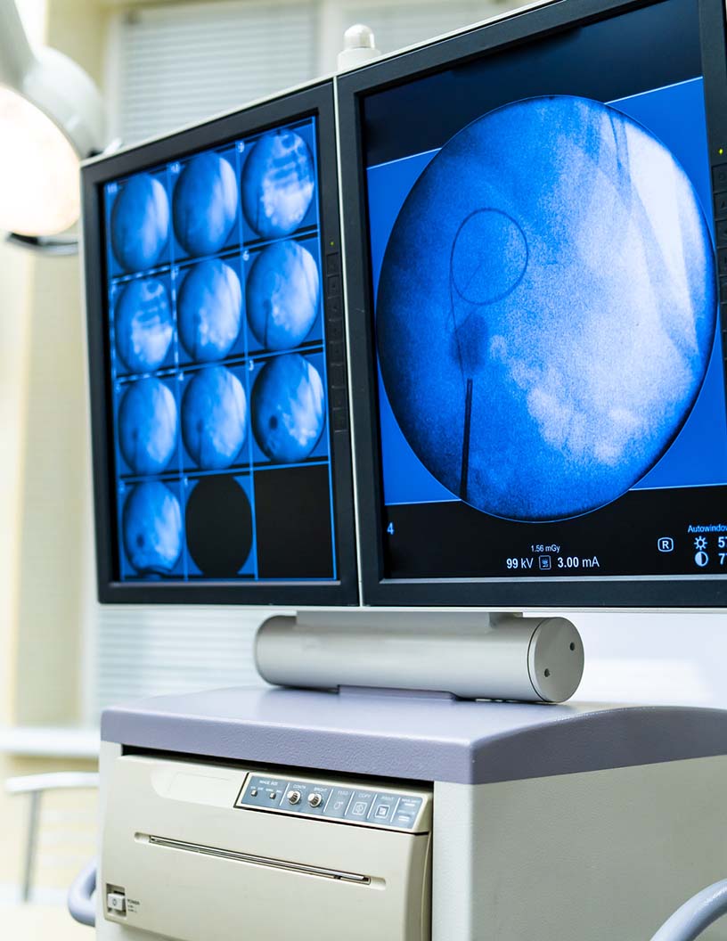 #US Medical Display Monitors Market Set for Dynamic Growth: AI Innovations and Advanced Imaging Systems Driving Transformative Changes in Healthcare! #Healthcare #MedicalTechnology #Imaging #AI 

Explore comprehensive insights: shorturl.at/DVTd7