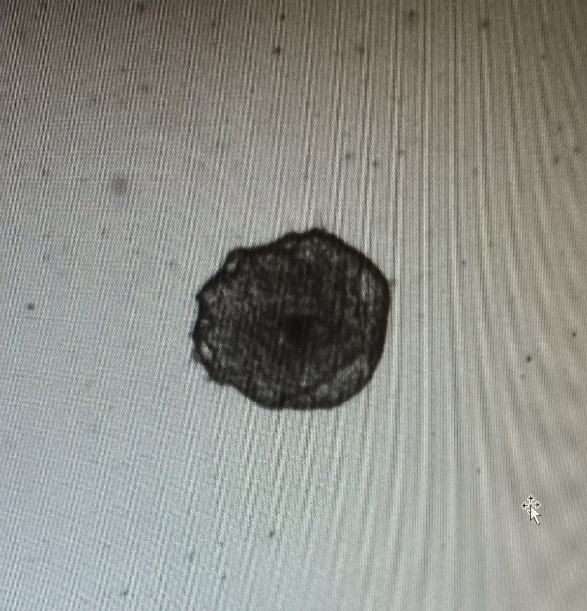 Bailey__Bye's tweet photo. My spheroids are certainly getting in the Halloween spirit 👁️😨🫣

(Who’s watching who…) https://t.co/zjWrVrMxBb