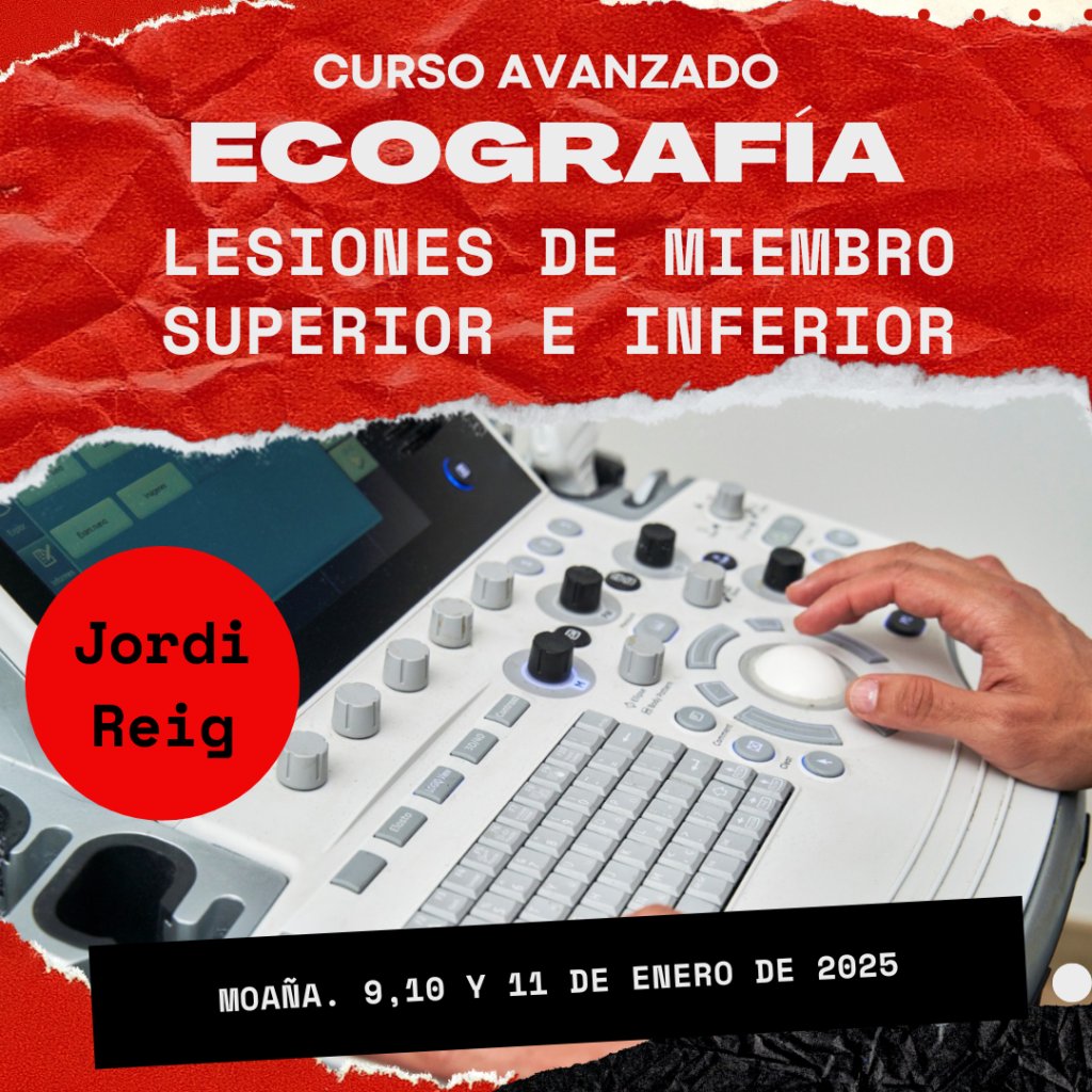 ¿Aún no te has apuntado a nuestro curso de ecografia avanzada?

Contaremos con el gran <a href="/jordireigfisio/">Jordi Reig Fisio</a> en esta nueva edición,  ya que en la primera el curso colgó el cartel de completo.

¿Y si lo hemos otra vez?

ecufis.com/curso/curso-av…