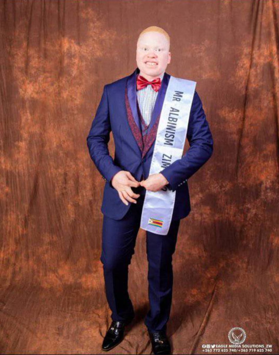 PLEASE RETWEET 

Mr Albinism Zimbabwe, University of Zimbabwe SRC Vice President, and Chairperson of the organising team for Mr and Miss Albinism Africa 2025, Lordwin Rimire, is running a sunscreen lotion donation campaign for people with albinism.

Due to increased temperatures,