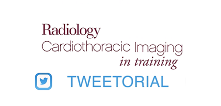 Jordan Chamberlin MD (@jordanc_md) on Twitter photo This week’s <a href="/RadiologyCTI/">Radiology: Cardiothoracic Imaging</a> tweetorial brings you a special look at MV geometry after cardiac resynchronization (CS). We take a deeper look at changes in MV structure after CS in detail never seen before with #YesCCT. (1/10)
pubs.rsna.org/doi/10.1148/ry…
#InTrainingRCTI #TweetorialRCTI This week’s <a href="/RadiologyCTI/">Radiology: Cardiothoracic Imaging</a> tweetorial brings you a special look at MV geometry after cardiac resynchronization (CS). We take a deeper look at changes in MV structure after CS in detail never seen before with #YesCCT. (1/10)
pubs.rsna.org/doi/10.1148/ry…
#InTrainingRCTI #TweetorialRCTI
