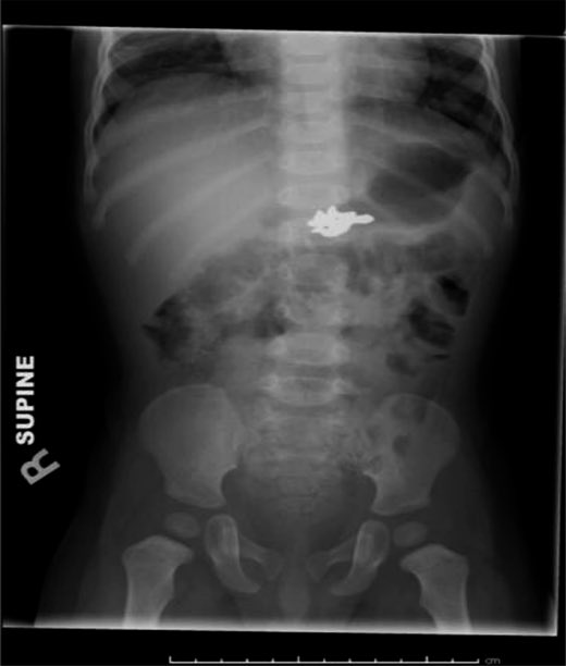 PEHSU: New England tweet media