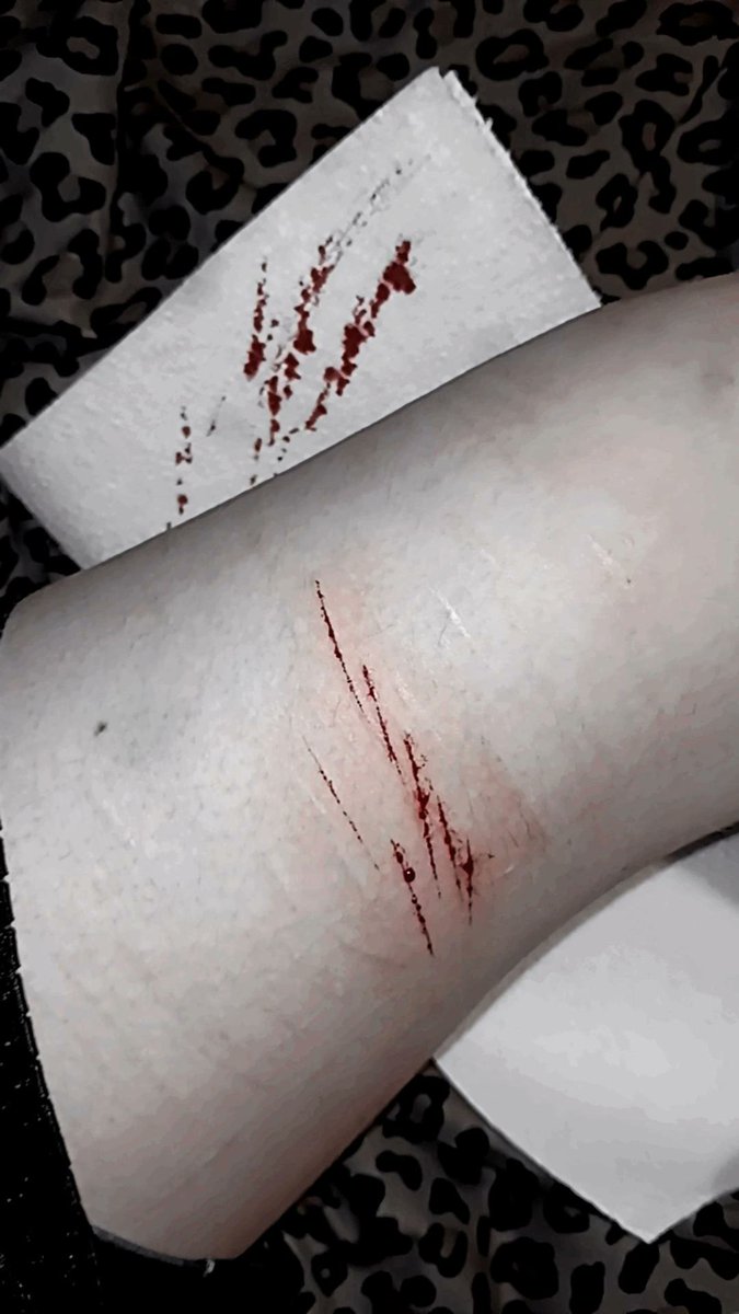 small relapse and I don't even post anymore, just disappointed I let almost a year of being clean go