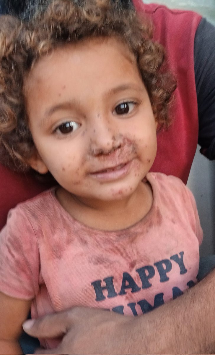 Fora22Z's tweet photo. My little girl, her name is Shahd, she is 2 years old, she has a skin disease because of the war and pollution from the shells and phosphorus, and I am unable to treat her because of the war and the genocide. I address you with appreciation and respect for helping this innocent https://t.co/AsJcw9Ko8a