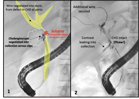 Sahaj Rathi MD, DM, MRCP tweet media