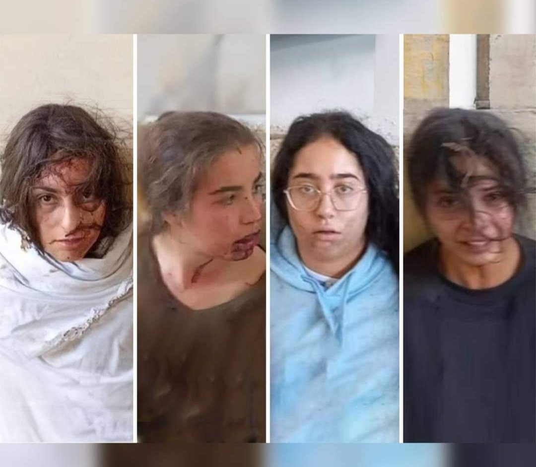 אנחנו כפסע מהשיכחון המוחלט