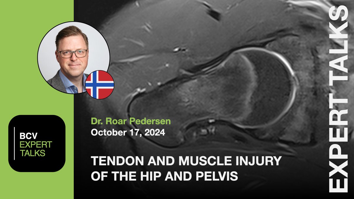 Kay G. Hermann (@bonerad) on Twitter photo Today, 4:00 PM CEST! Our speaker is Roar Pedersen, top expert in sports imaging. We’re diving into avulsion injuries, tendon ruptures & chronic tears. 3 CME credits as well as accredited by <a href="/ESSRmsk/">European Society of Musculoskeletal Radiology</a> for their diploma! Secure your seat now for just 59€!
🔗 bcv.app/talks Today, 4:00 PM CEST! Our speaker is Roar Pedersen, top expert in sports imaging. We’re diving into avulsion injuries, tendon ruptures & chronic tears. 3 CME credits as well as accredited by <a href="/ESSRmsk/">European Society of Musculoskeletal Radiology</a> for their diploma! Secure your seat now for just 59€!
🔗 bcv.app/talks