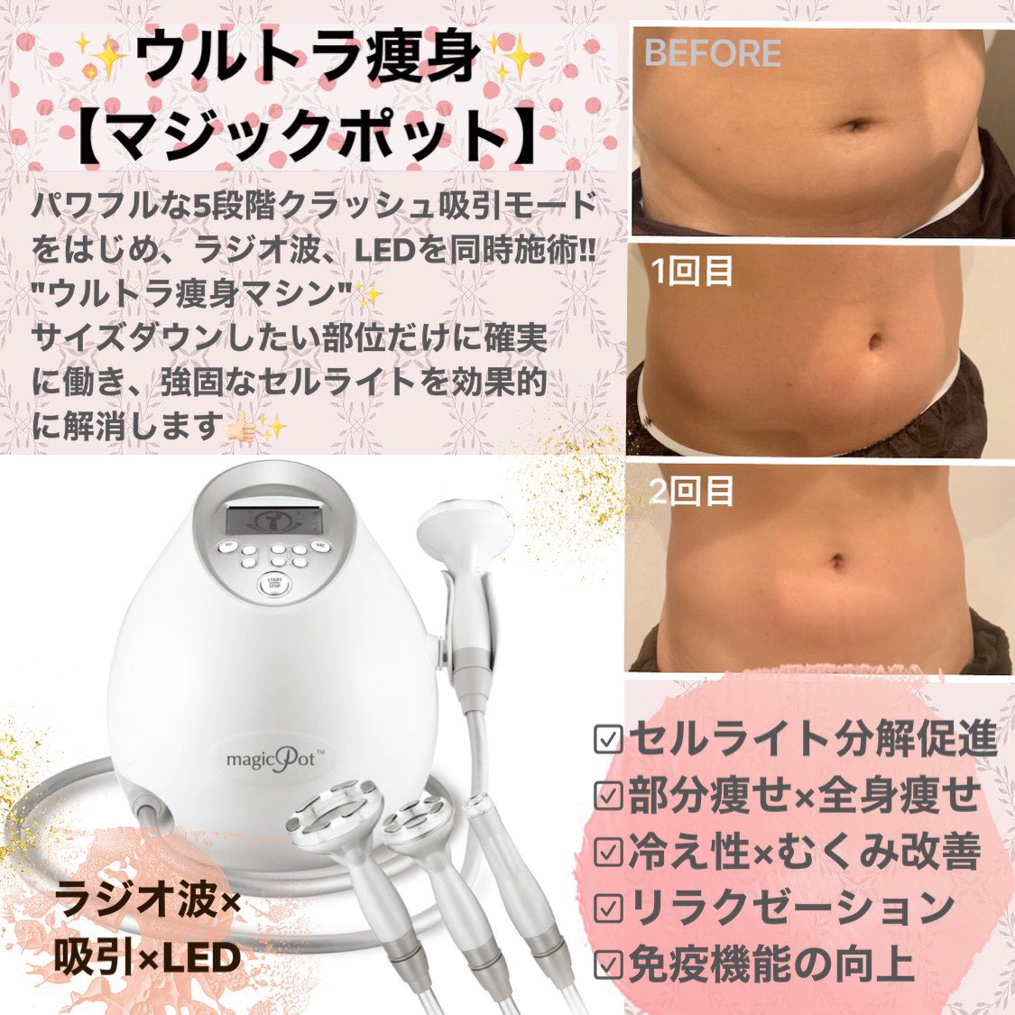 マジックポット ラジオ波クラッシュ吸引｜コスメ・美容 