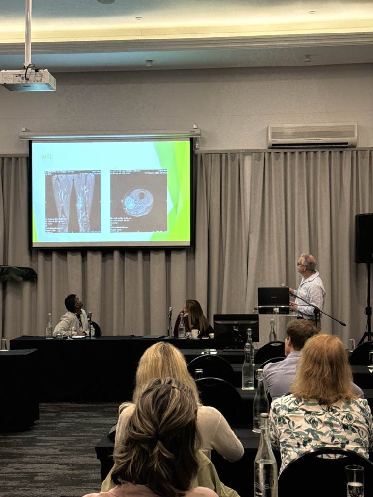SASMA_ZA's tweet photo. The first workshop, Exercise and Cancer, is kicking off with Dr Derek Du Plessis presenting the first clinical case. An exciting start to Day 1! 🩺🏃♂️ #SASMAConference2024 #ExerciseAndCancer #SportsMedicine https://t.co/u3X5gakpAE